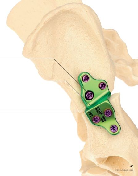Kyon DPO Double Pelvic Osteotomy Starter Kit