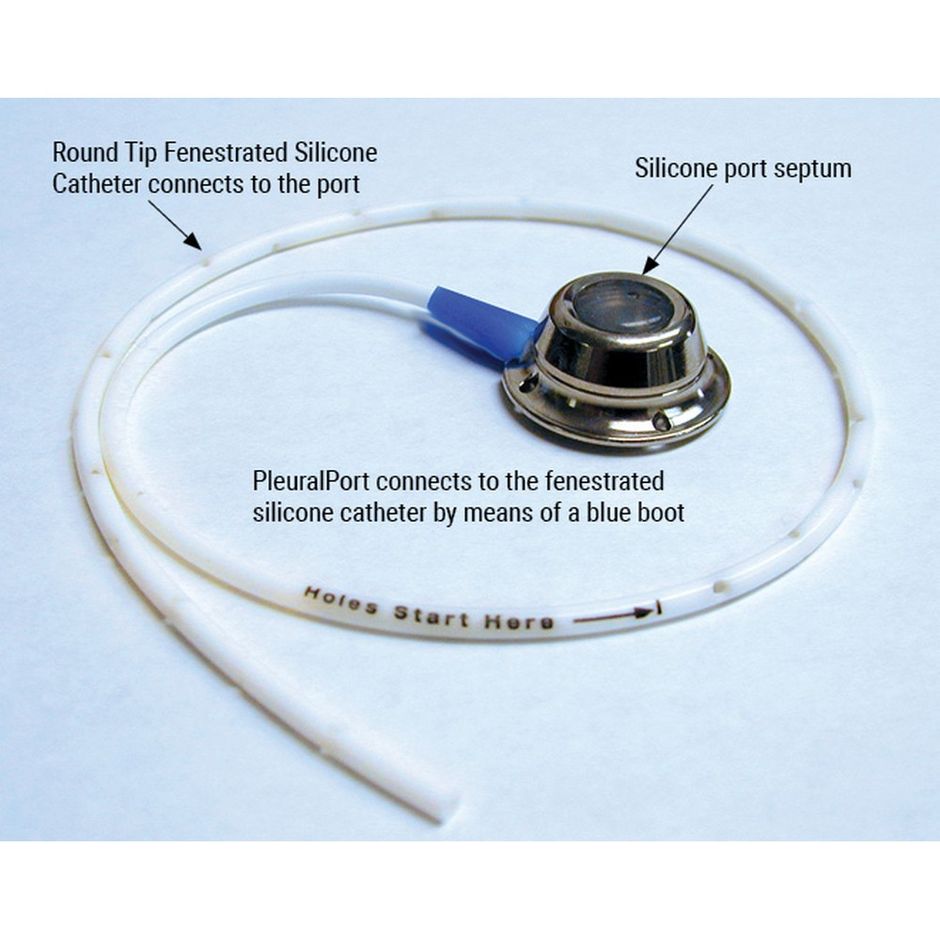 Norfolk PleuralPort System Drainage Kit