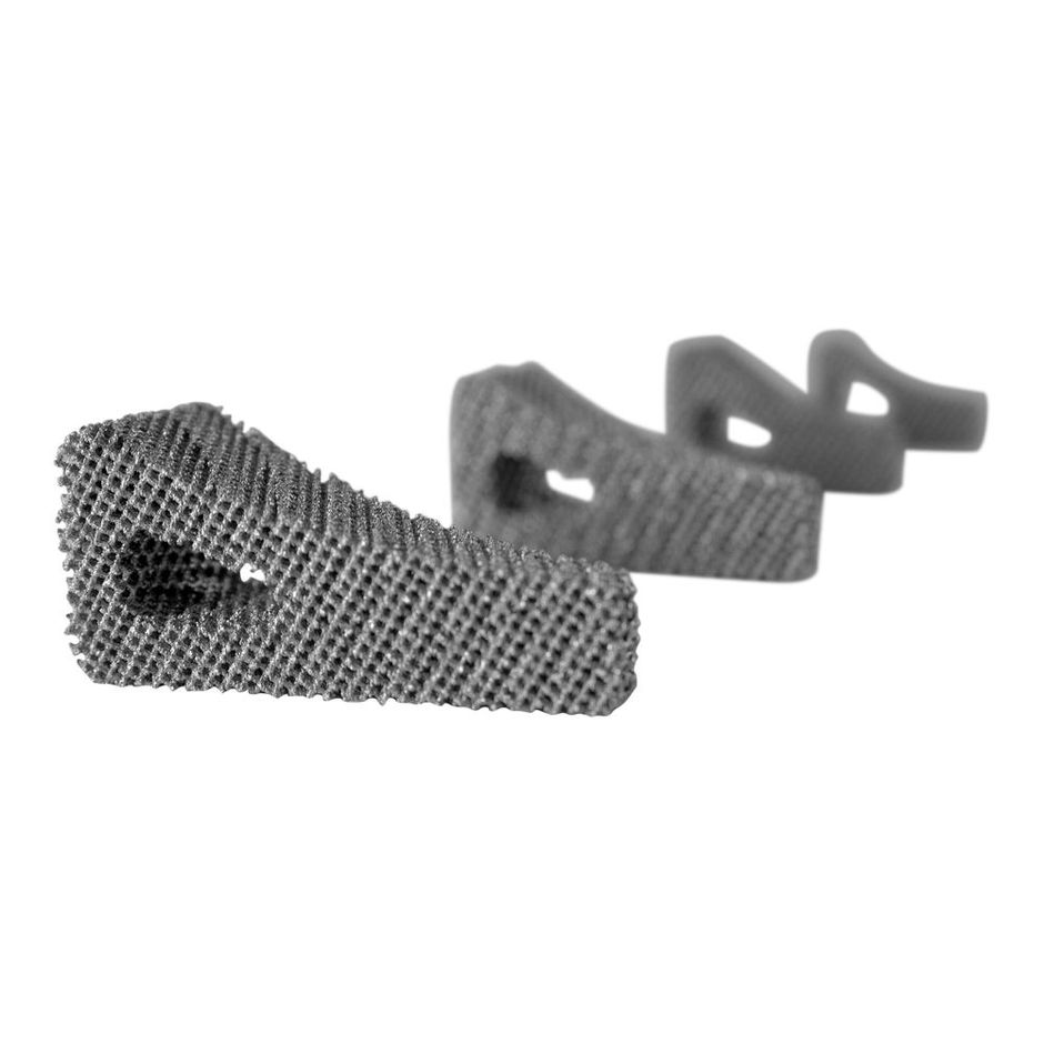OssAbility Wedge Implant